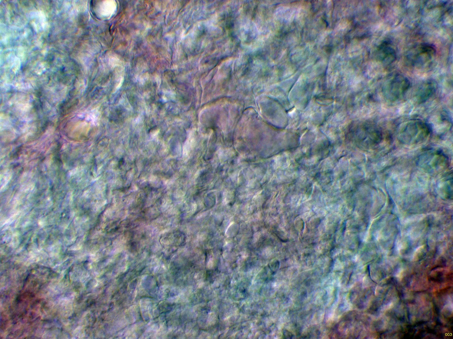 Microscopía de Leucogaster nudus - 10 - Hifas trama-003